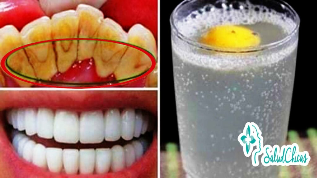Remedios naturales para la salud de nuestros dientes 